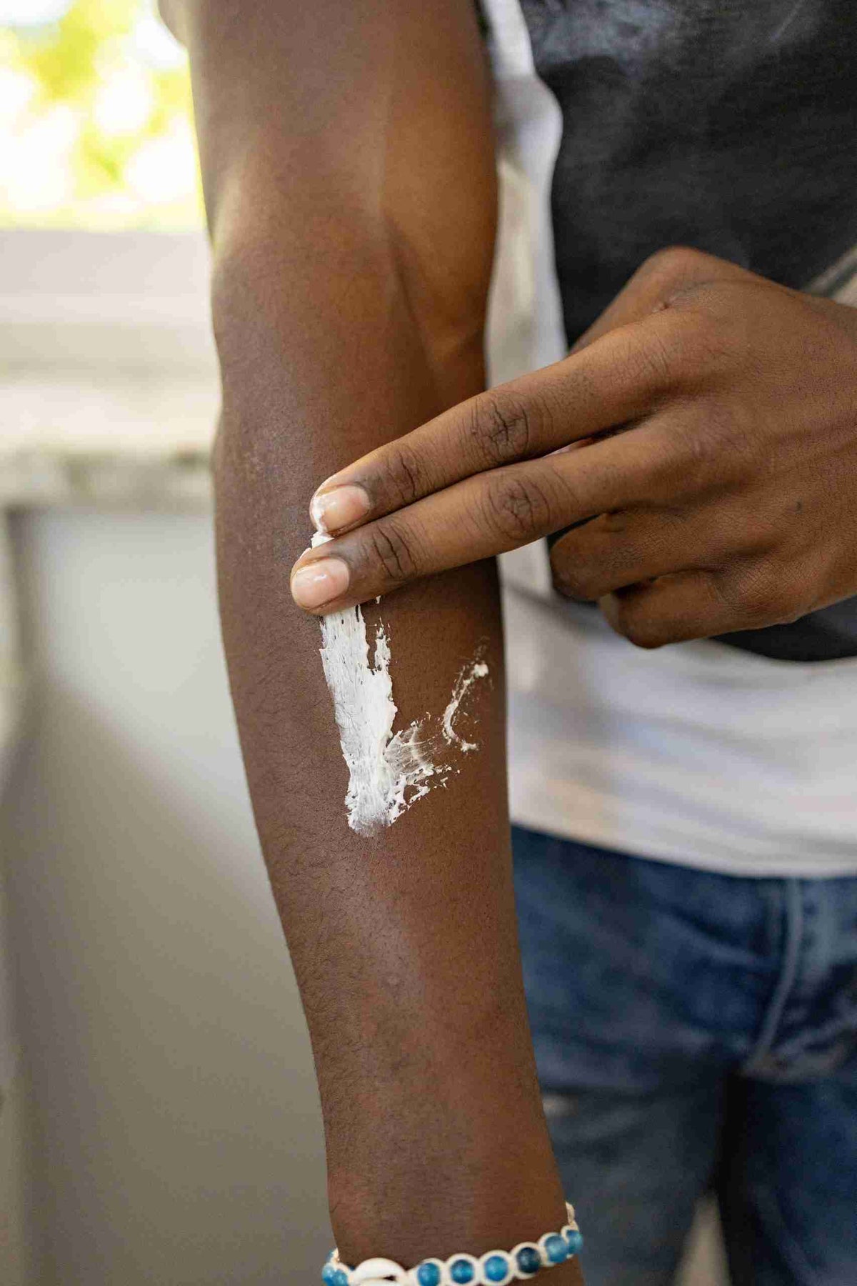Is Beef Tallow The Best Sunburn Remedy?