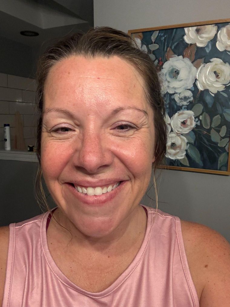 When Menopause and Medication Changed Her Skin